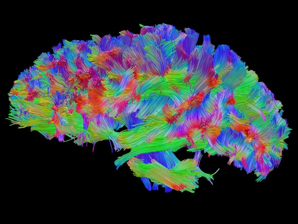 TBI uninjured left side WholeBrainSagRGB